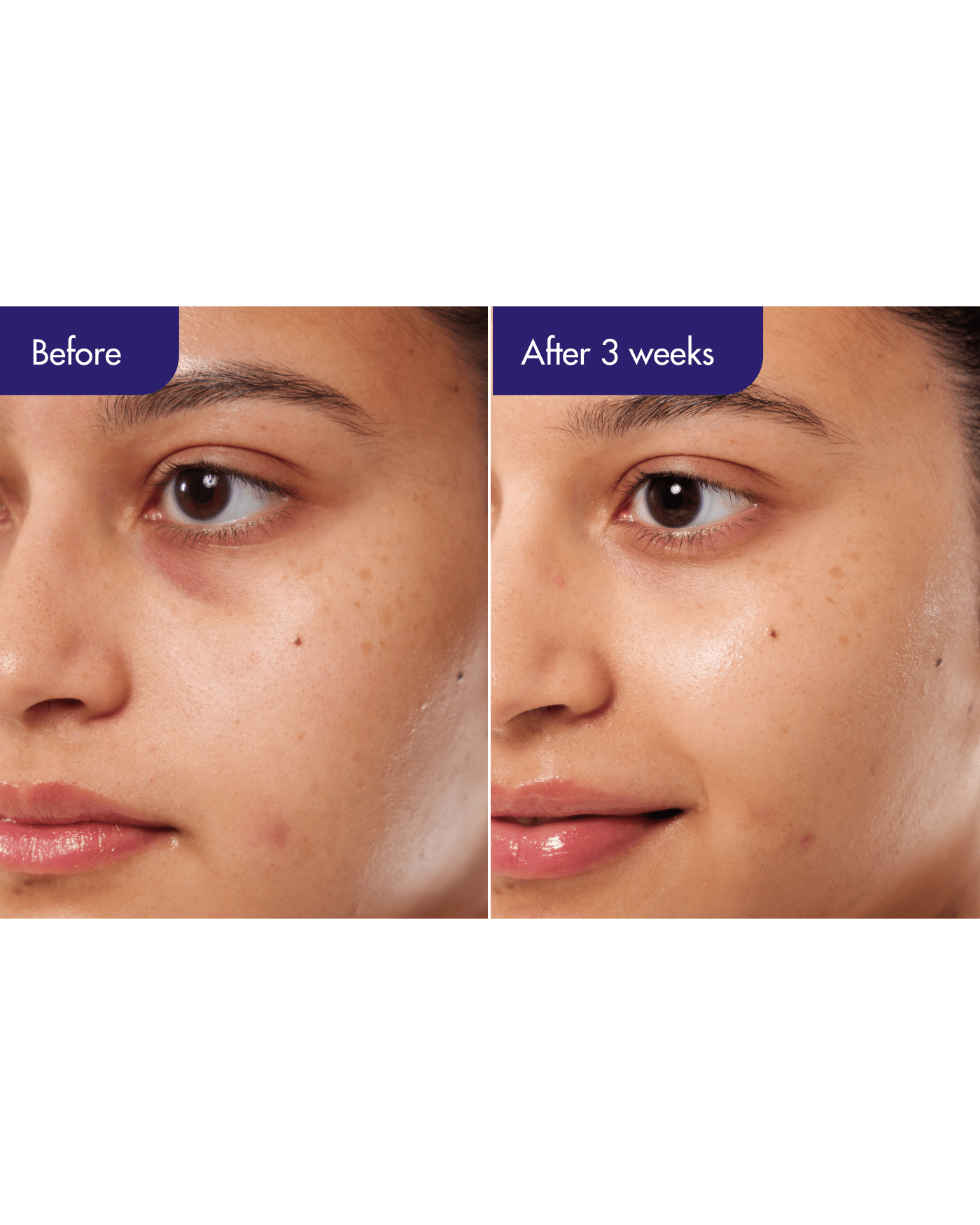 IOPE PDRN Caffeine Shot Serum Plant-Based PDRN + Caffeine Firming Serum