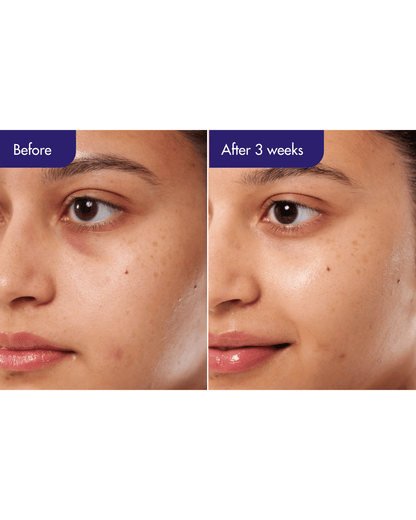 IOPE PDRN Caffeine Shot Serum Plant-Based PDRN + Caffeine Firming Serum