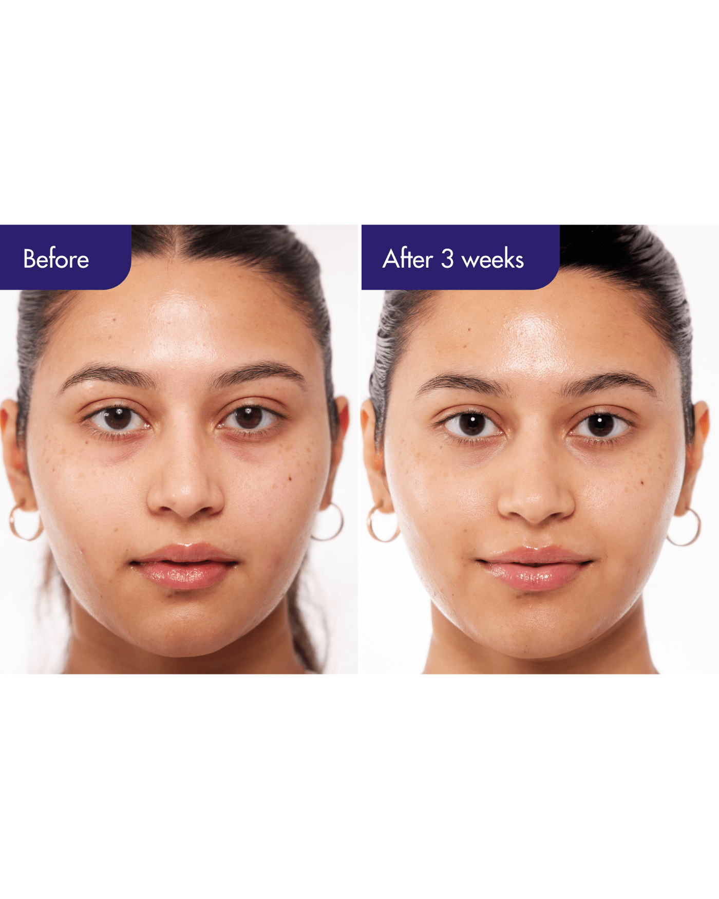 IOPE PDRN Caffeine Shot Serum Plant-Based PDRN + Caffeine Firming Serum