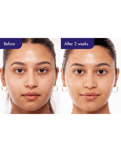 IOPE PDRN Caffeine Shot Serum Plant-Based PDRN + Caffeine Firming Serum